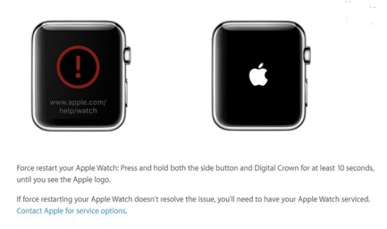 小心了 Apple Watch更新watchOS 3.1.1后可能变砖