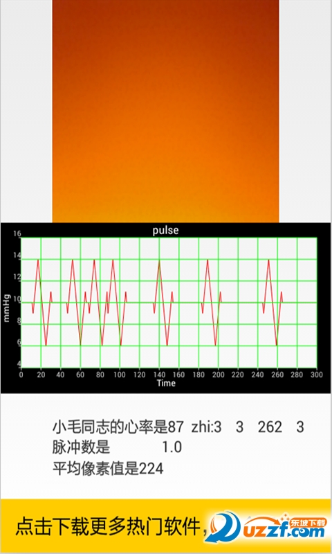 手机心电图仪安卓版截图2